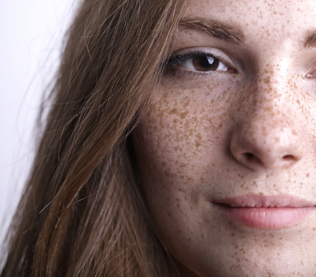 GIRL WITH FRECKLES